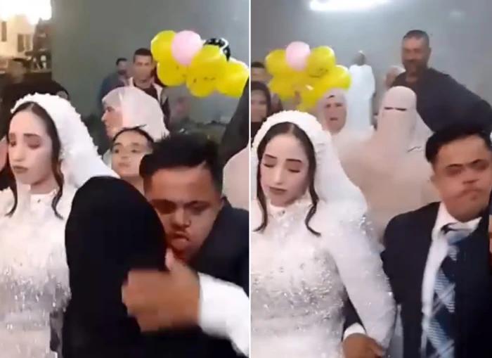 You are currently viewing  حفل زفاف مصاب بمتلازمة داون يثير جدلا واسعا في مصر