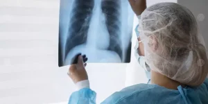 Read more about the article اكتشاف طريقة فعالة لعلاج سرطان الرئة