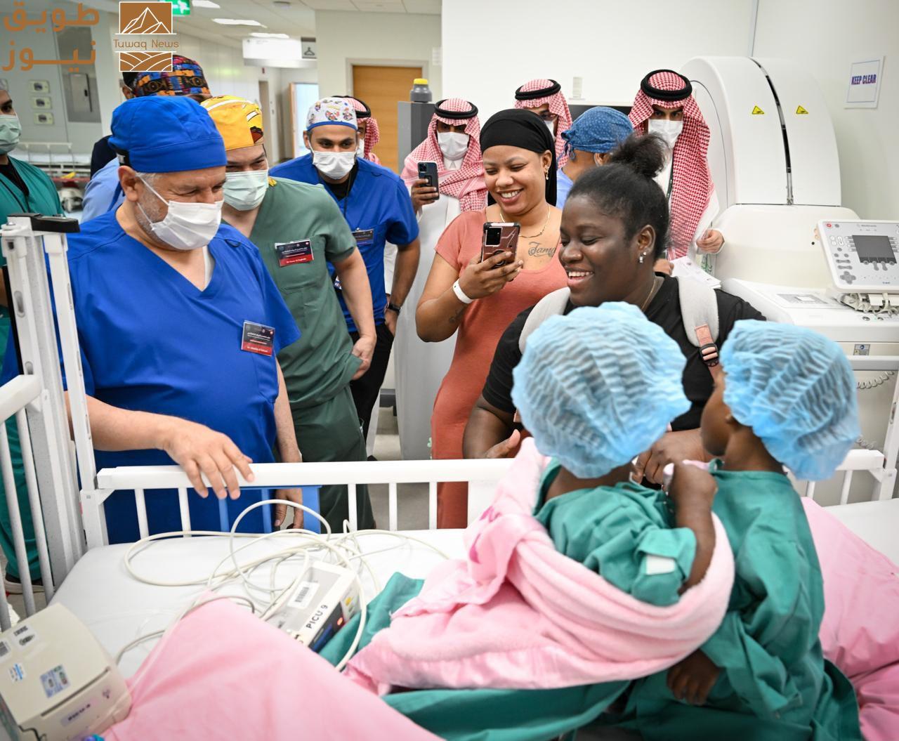 Read more about the article نجاح فصل التوأم الملتصق الجامايكي «أزاريا وأزورا» بالرياض