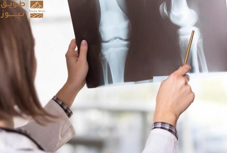 Read more about the article طريقة جديدة للكشف المبكر عن هشاشة العظام